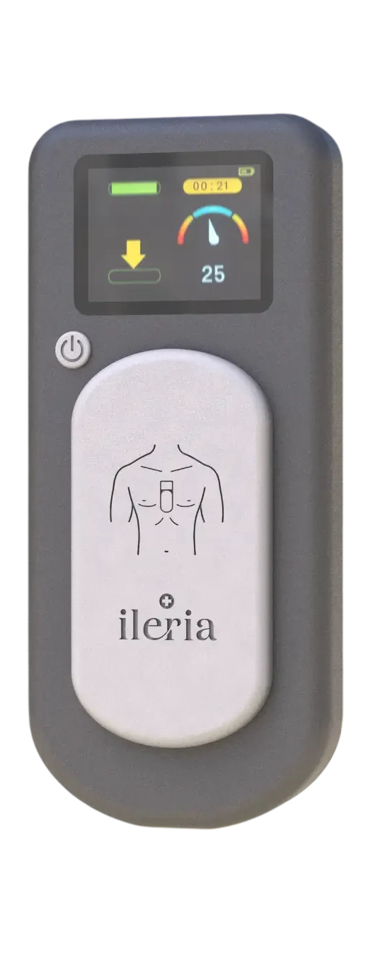 Ileria CPR Feedback Device
