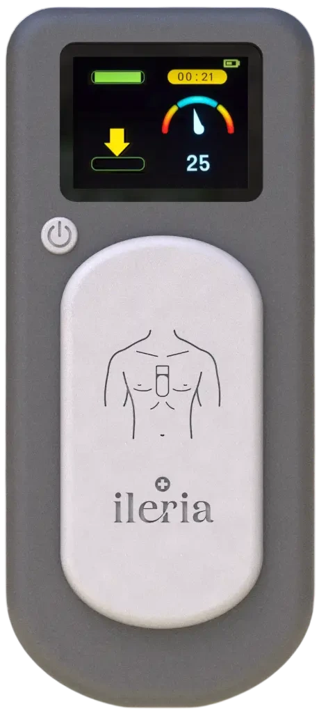 Ileria Smart Feedback Device